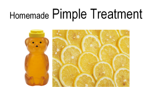 Homemade Pimple Treatment