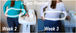 i-Lipo Reviews 3